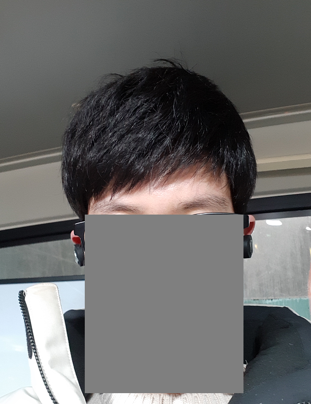 이건 수술 전 겨울에 가발 쓰고 다닐때 모습입니다. 볼륨감과 풍성함. 굵기 질감을 보세요.