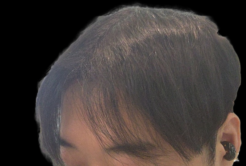 A review of surgery at the hospital in MOM, Gangnam