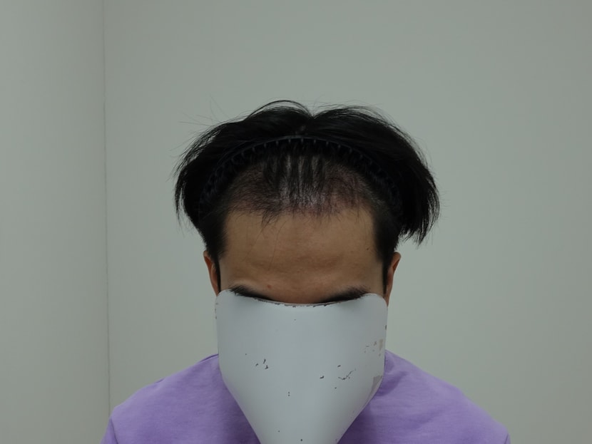 3개월차