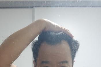 1.수술전