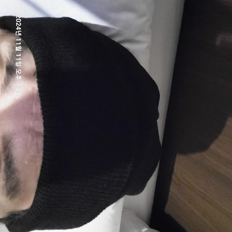 오늘 4번째 모발이식을 받았습니다ㅋ