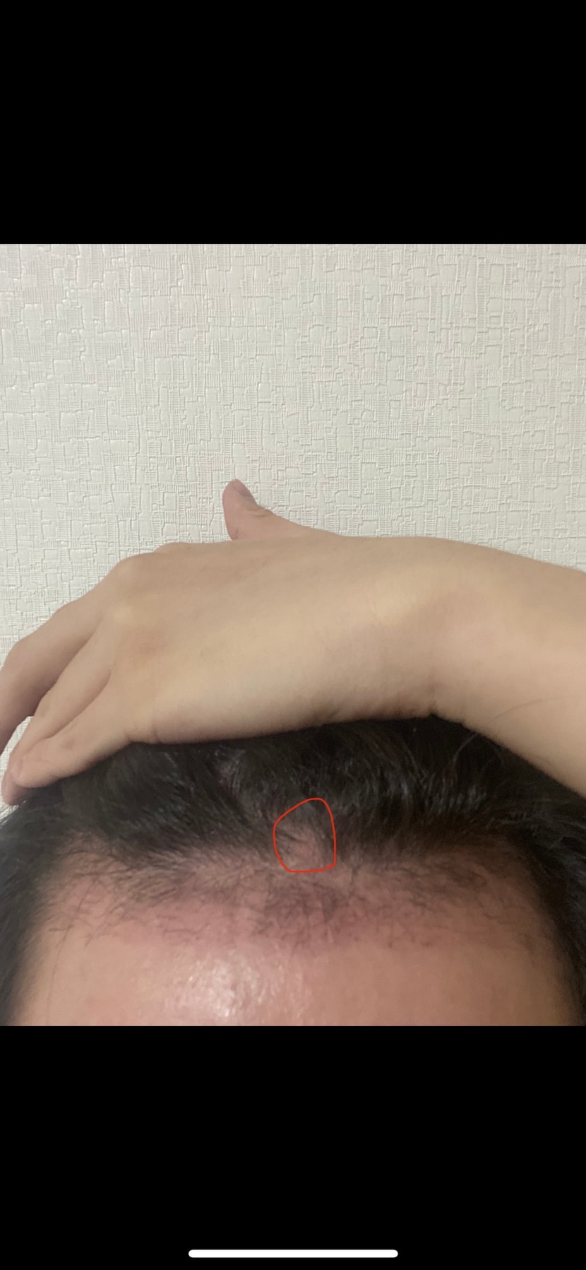 35일차 오늘