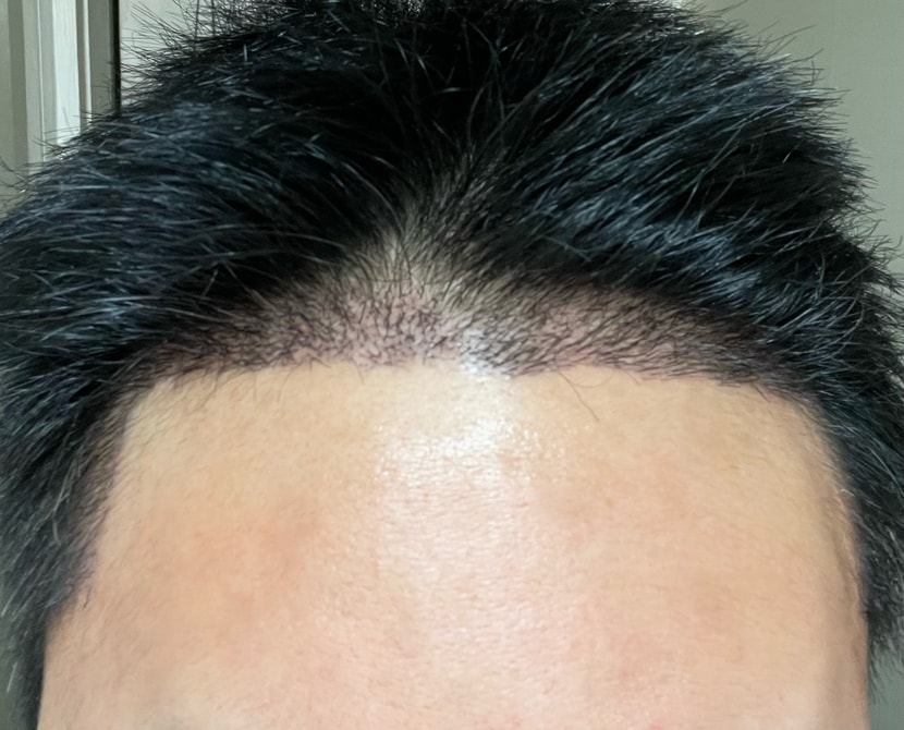 지문 샴푸 후