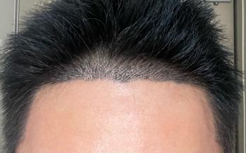 지문 샴푸 전