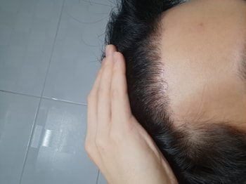 왼쪽