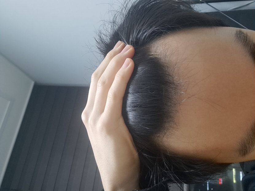 수술 전