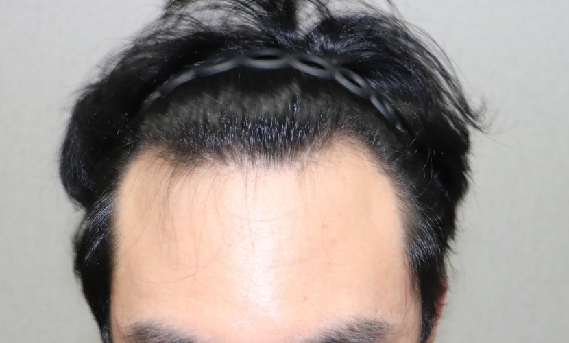 수술 전 촬영 사진 입니다.