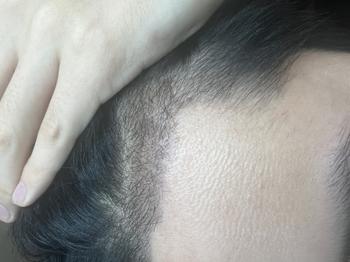&lt;18일차 좌측&gt;