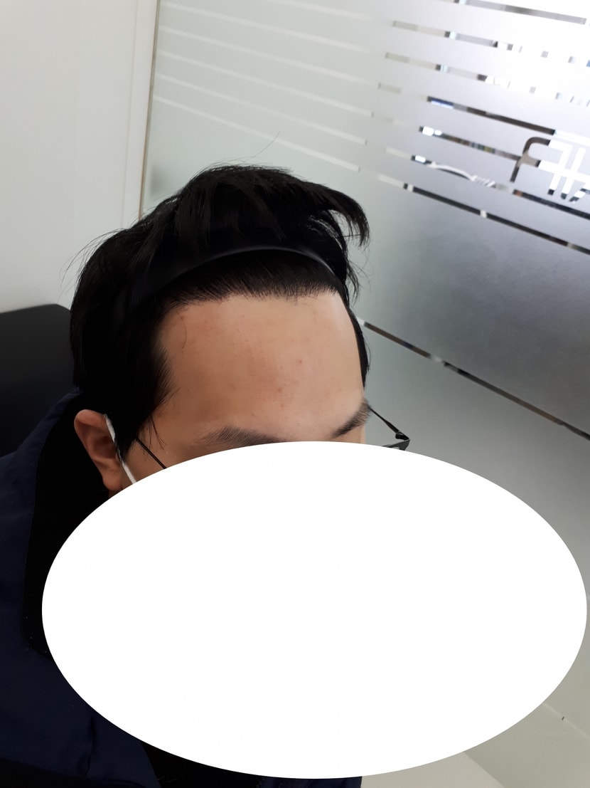 1년경과대기중