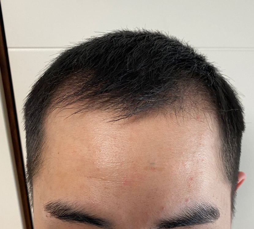 2달차