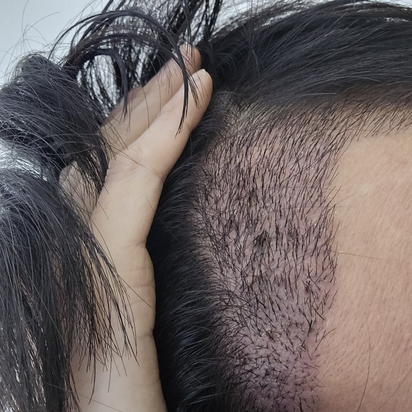 정상부분