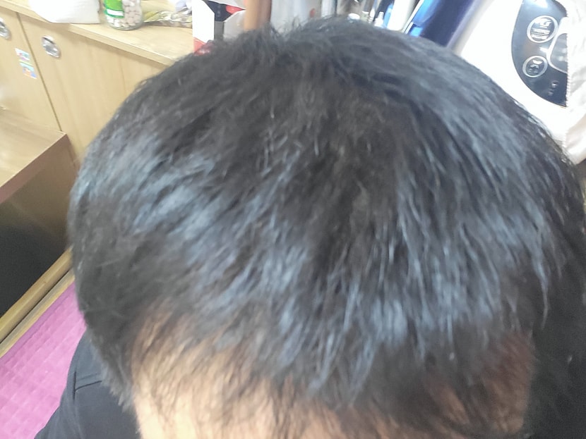 5개월이 지나서 모발에 힘도 생기고 촘촘해졌어요