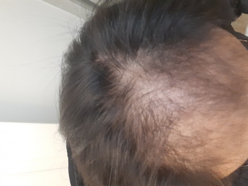 이 사진은 6개월 전에 이식 전 사진입니다.