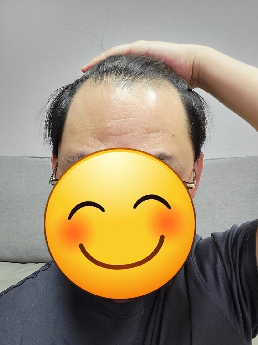 수술전날