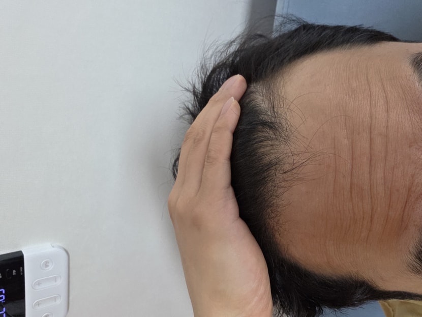 121일 차 (50%정도 개선)
