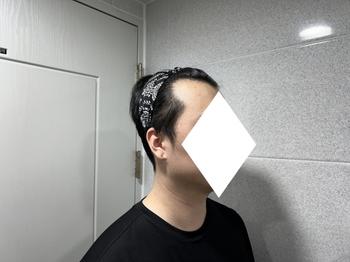 수술 전