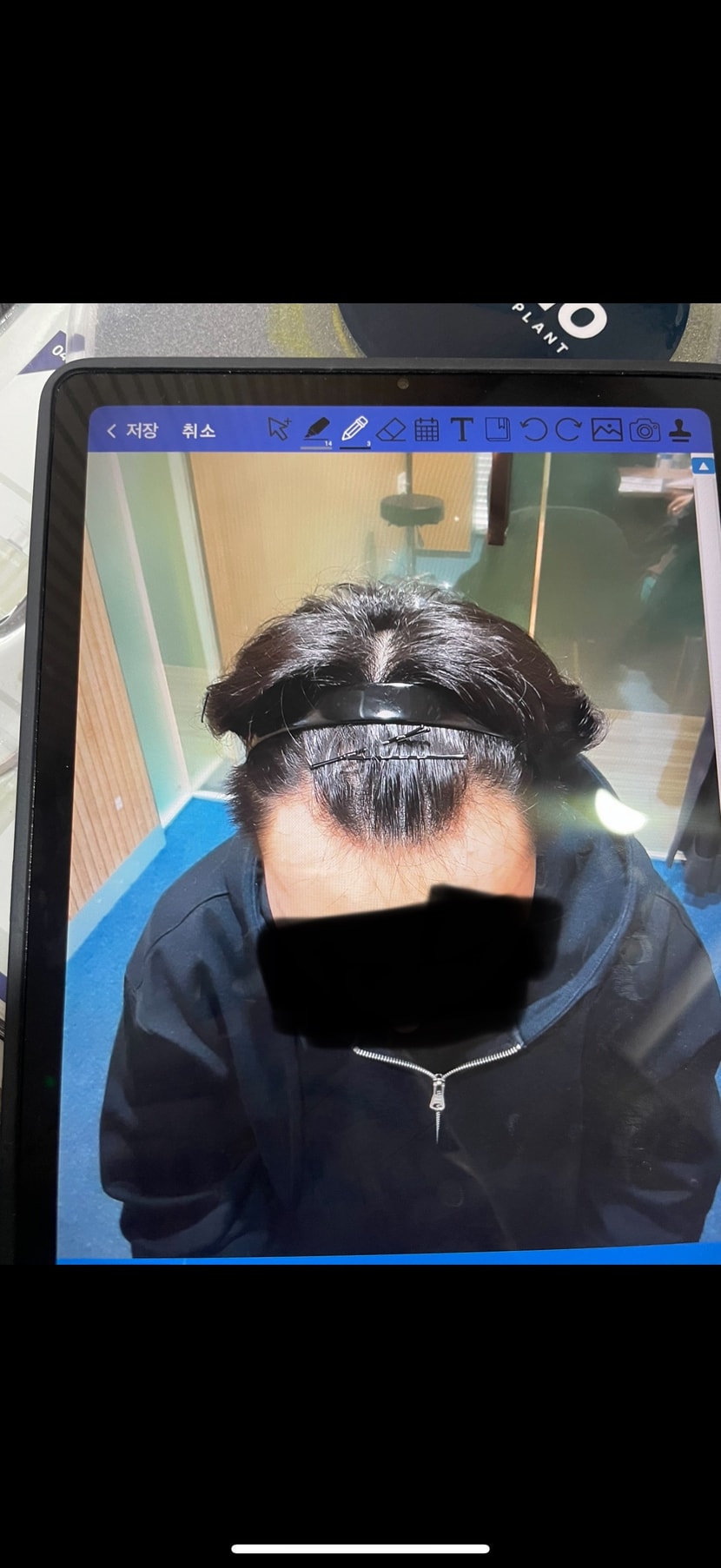1년전
