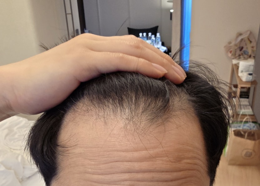 37일차 M