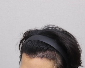 후