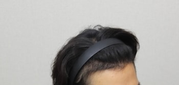 후
