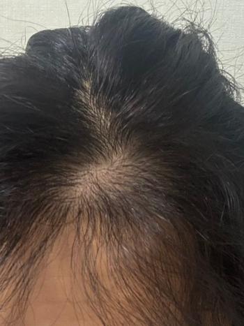 1년차 사진인데 밀도 많이 비어보이죠?