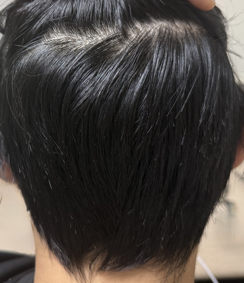 뒤통수