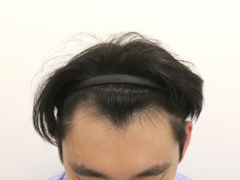 수술전