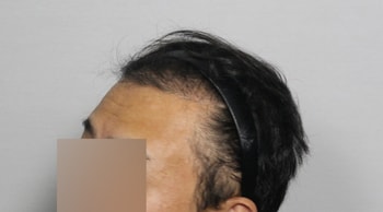 &lt; 보강 후 &gt;
