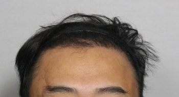 &lt; 보강 후 &gt;