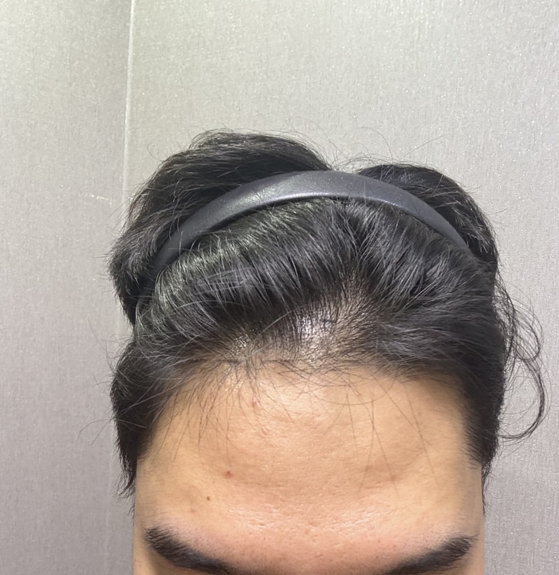 지방러의 서울병원 투어 후기(광고아님)