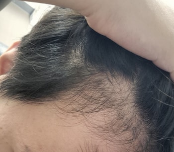 오른쪽