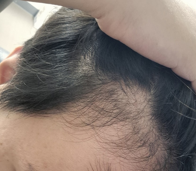 오른쪽