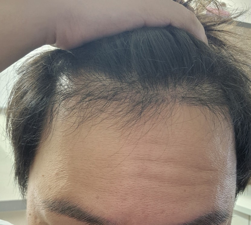 정면