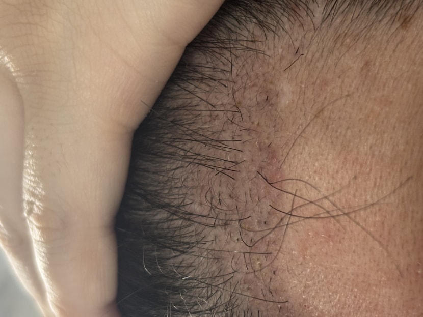 90일차 왼쪽 확대사진