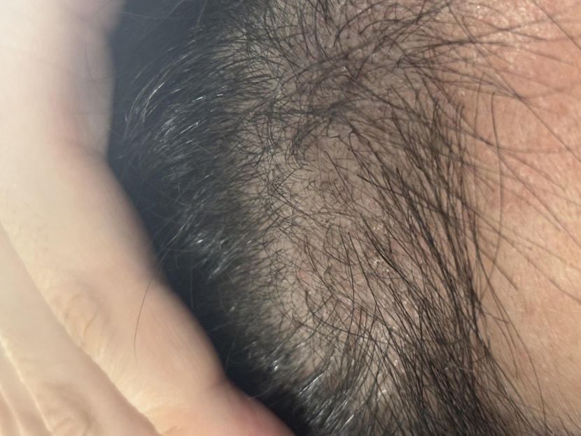 90일차 오른쪽 확대사진