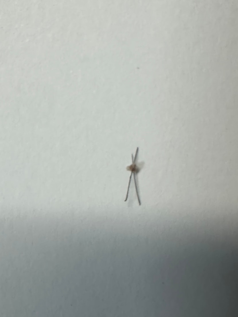 딱 이런식으로 빠지네요 ㅠㅠ