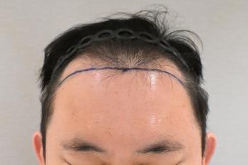 정면