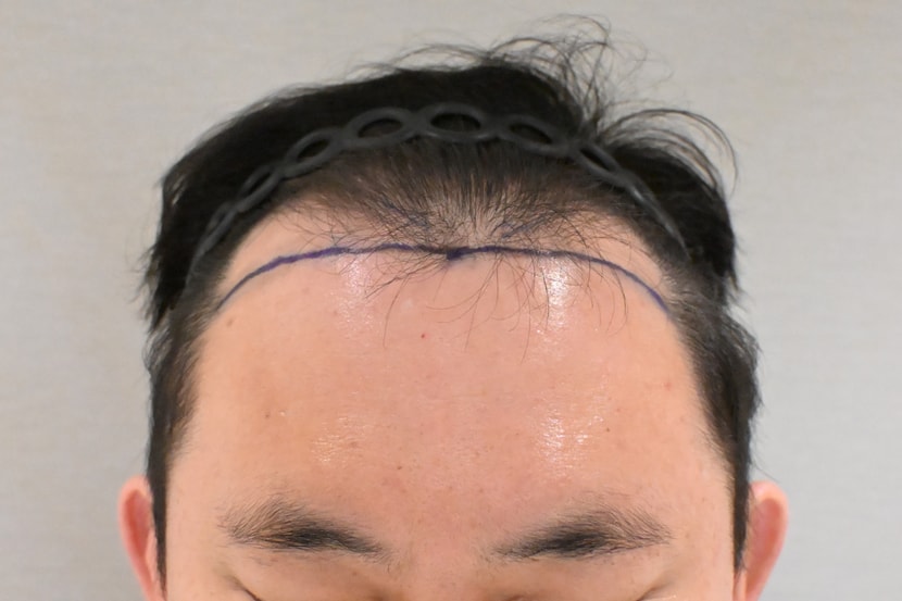 정면