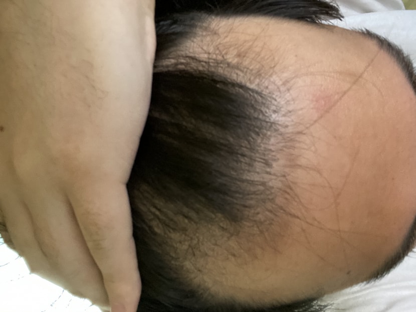 수술전날 직접찍은