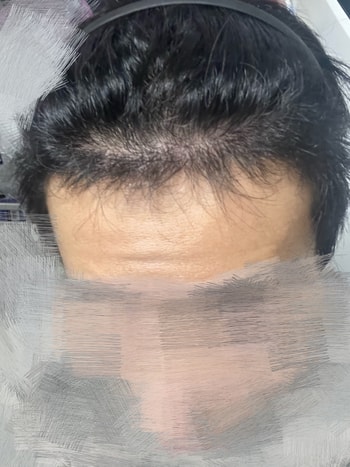 4개월 차