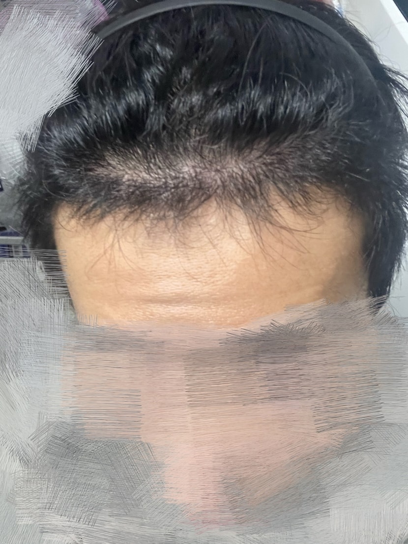 4개월 차