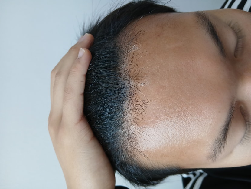 정면이랑 옆에쪽고 흉터가 안보입니다