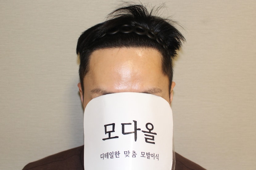 6개월 후
