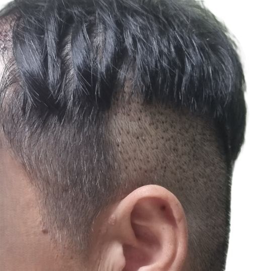 공여부 옆머리만 살짝~