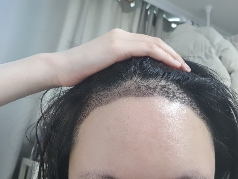 16일차 샴푸후 사진