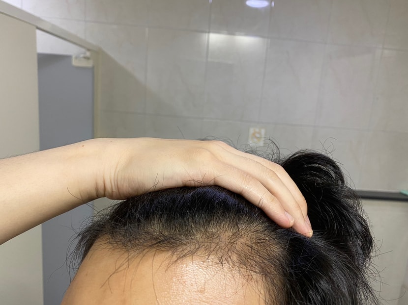 좌측1