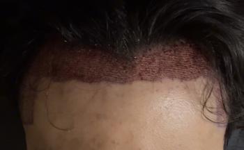 1일차