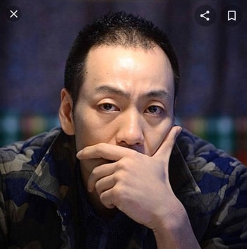 모발이식전 배우님