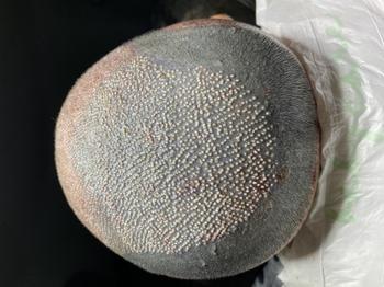 8월 27일 1차 (3000모낭), 8월 29일 2차 (2000모낭) 시술 진행. 정수리쪽에 두피문신해서 색깔이 다름.. 두피문신 신중하게 하세요..ㅠㅠ 그리고 마취주사 40방정도 놓는데 너무 아팠음... 시술 직후 누울 때도 불편하고 물 계속 뿌려주면서 피 안굳게 촉촉하게 유지시킴.. 약 2주?
