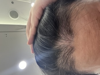 4개월차 현재